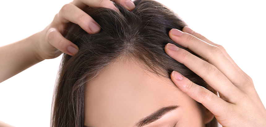 Haartransplantation bei Frauen