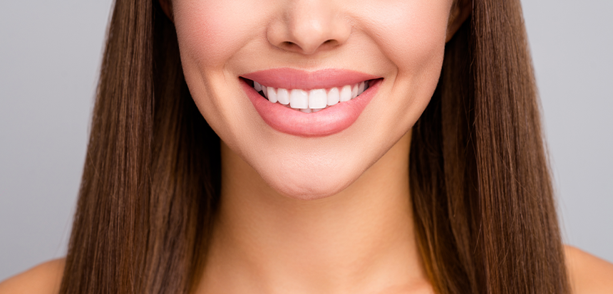 Hollywood Smile