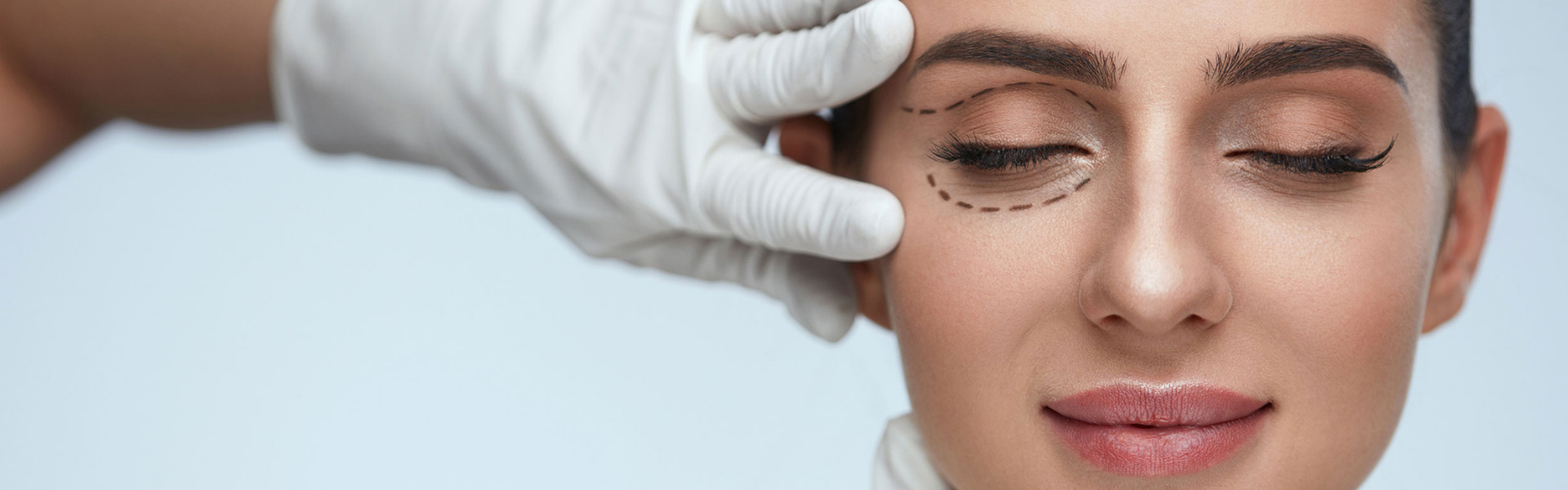 Was ist Oberlidästhetik/Oberblepharoplastik?