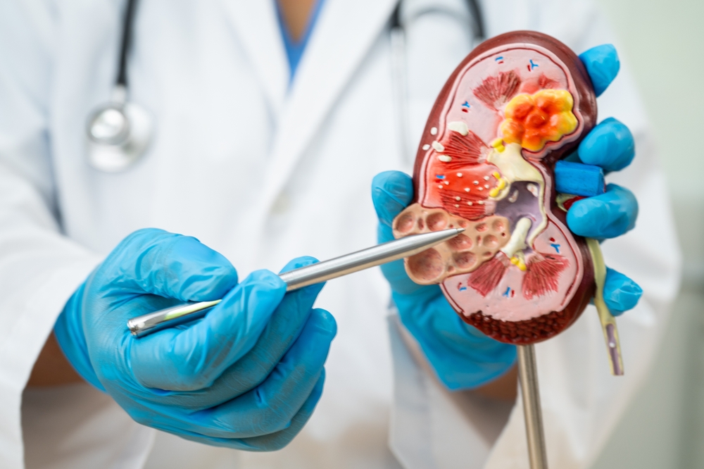 Retrograd İntrarenal Litotripsi (RIRS)